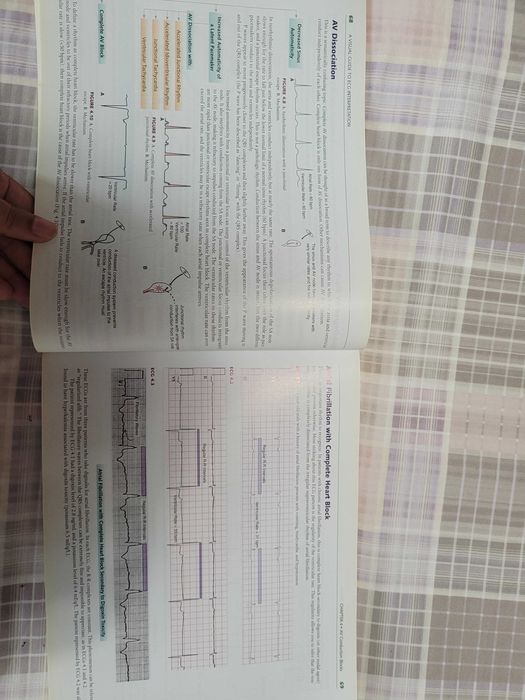 Medicina "A visual Guide to ECG interpretation" da Wolters Kluwer