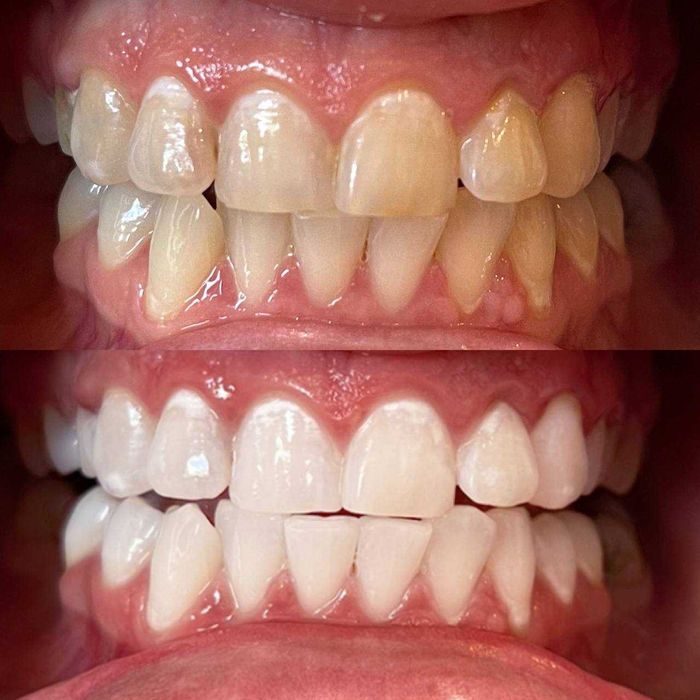 Косметичний бізнес / Франшиза відбілювання зубів Smile LAB