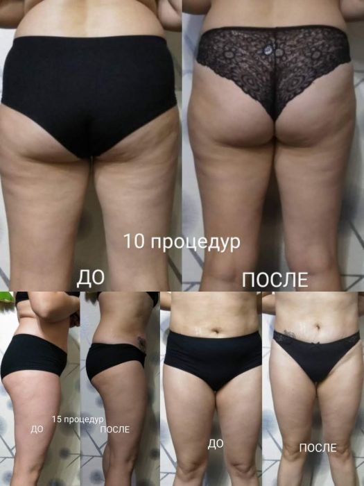 Массаж после тренировки! Одесская!