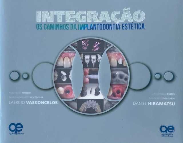Integração: Os Caminhos da Implantodontia Estética