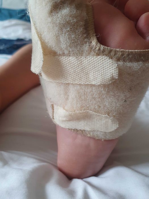 Бандаж(левый) при вальгусной деформации,травмах первого пальца.