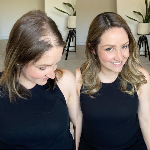 Curso Profissional de prótese capilar injetada em Alverca