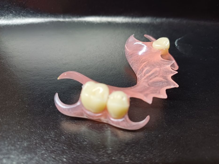 Зубний технік!Співпраця зі стоматологом