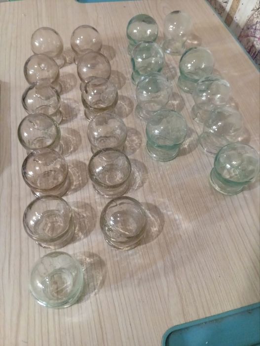 Банки вакуумні лікувальні масажні