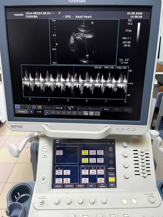 УЗД апарат Toshiba (Canon) Aplio XG