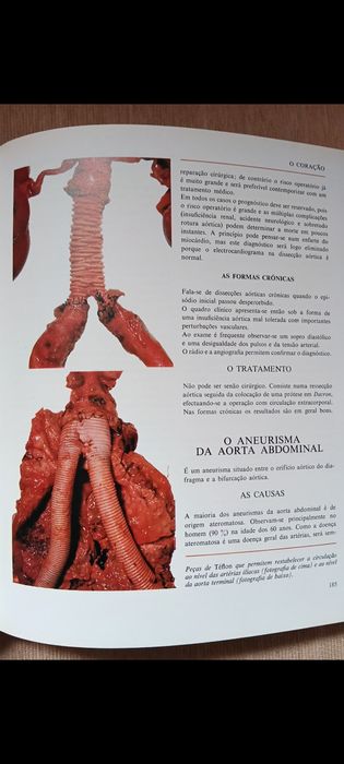 Enciclopédia Verbo "Coração/Artérias/Veias/Pulmões/Brônquios