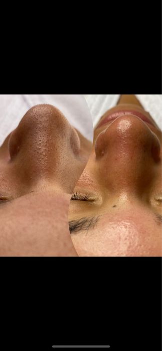 Massagem Profissional ao Domicílio | Resultados desde a 1ª sessão