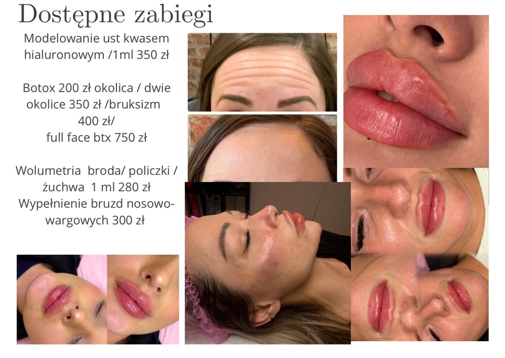 OSTATNIA SZANSA!  Modelki na zabiegi kosmetyczne
