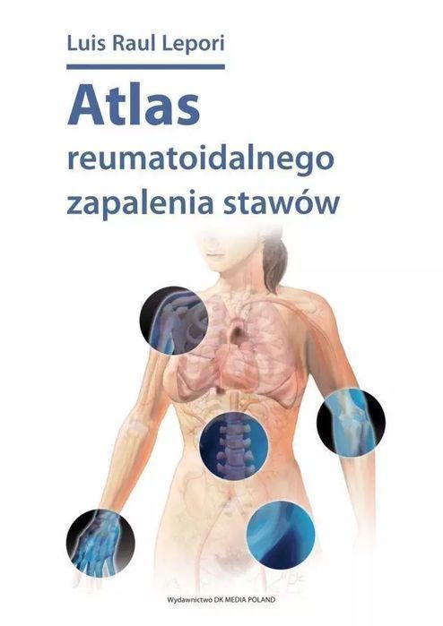 Atlas Reumatoidalnego Zapalenia Stawów Luis Raul Lepori