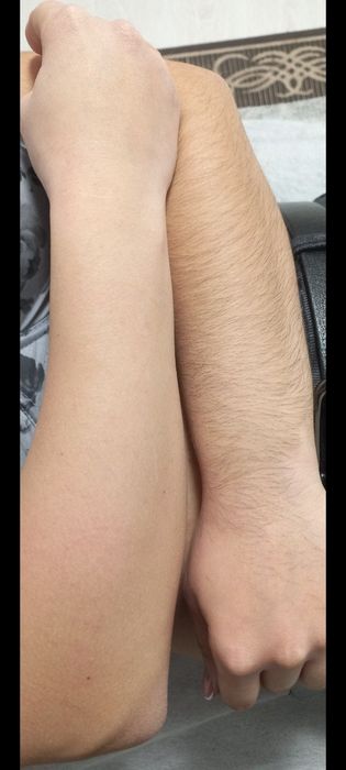 Депіляція для жінок і чоловіків, вагітних, підлітків