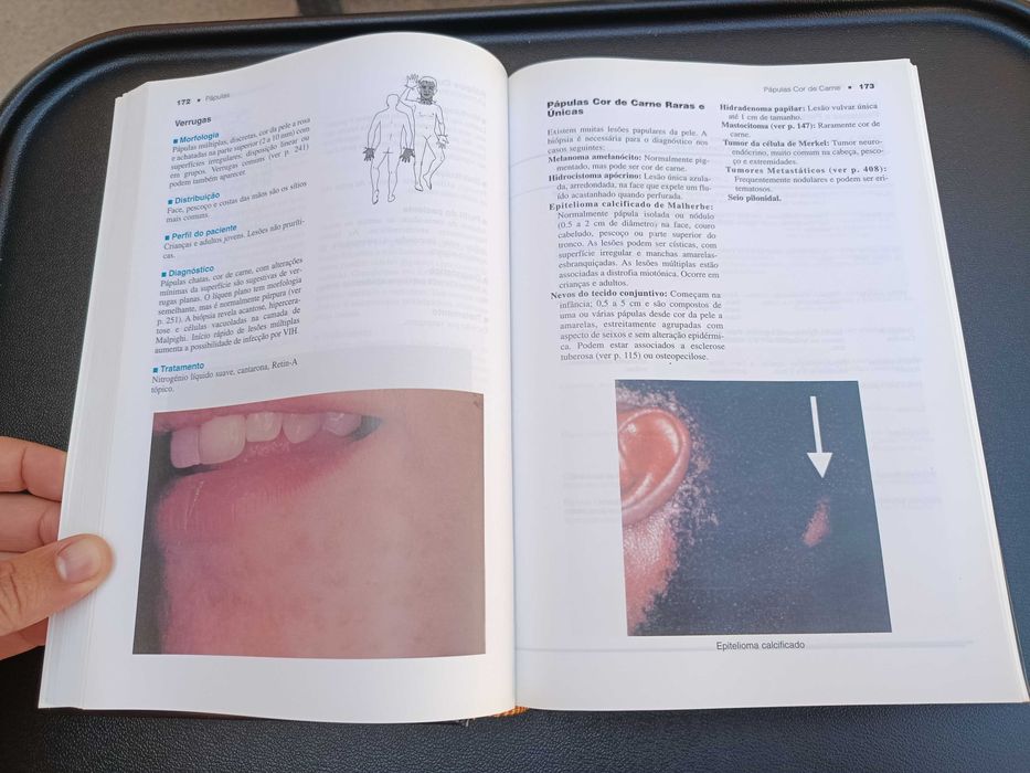 Livro "Dermatologia de Adultos e Pediátrica", de Lowell A. Goldsmith