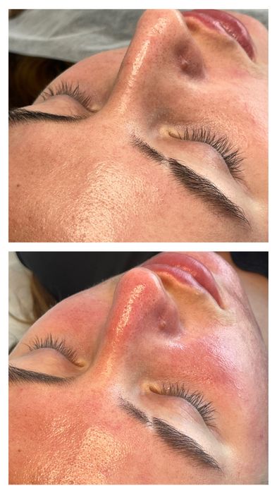 Косметолог:Чистка, пілінг,біоревіталізація, Позняки Драгоманова 2-Б