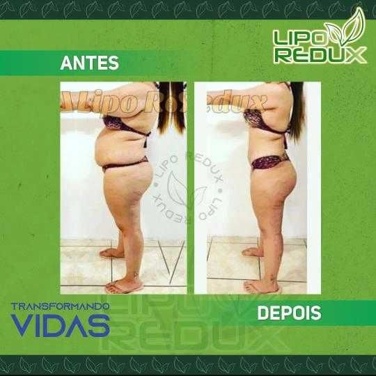 LIPOREDUX emagrecedor