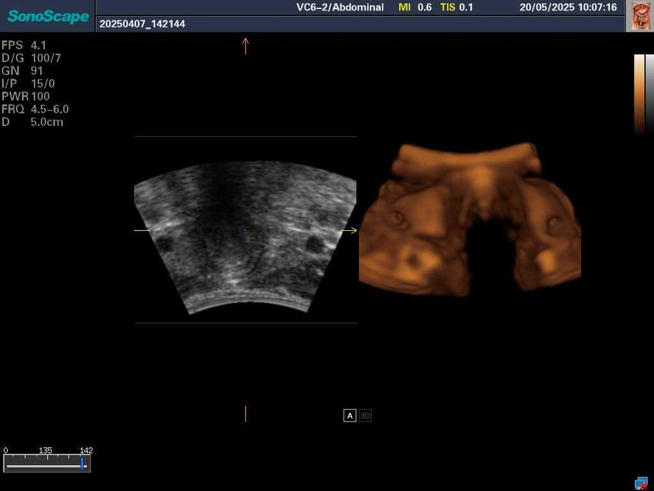 УЗИ\УЗД апарат SonoScape S8-Exp/Соноскейп/4 датчики/Еластографія/3D-4D