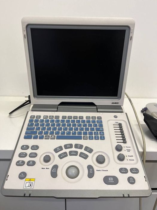 УЗД сканер Mindray DP-50 + 2 датчики + Сумка (В ідеальному стані)