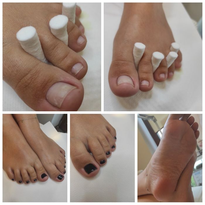 Podolog  mobilny, pedicure , manicure hybrydowy z dojazdem. Poznań. Luboń