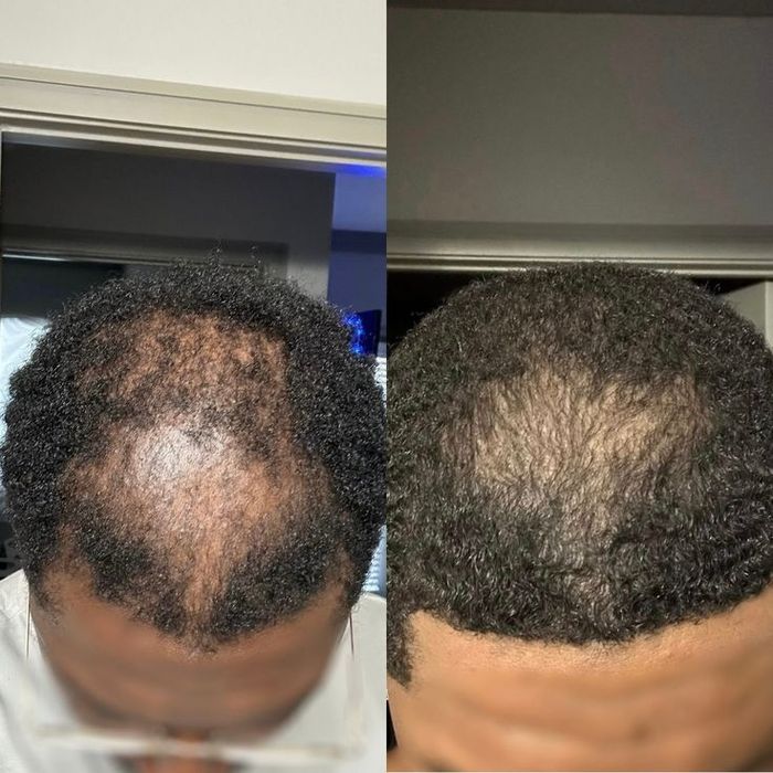 Tratamento natural " PELE E CABELO "