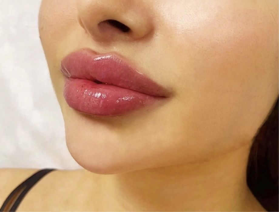 Увеличение губ !