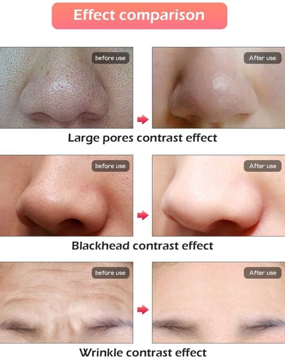 Maska LED na twarz i szyję, 7 kolorów