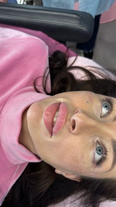 Контурна пластика, ін’єкції, ботокс