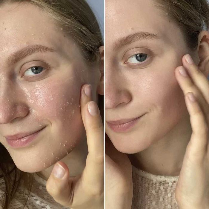 Пілінг-гeль для peгeнepaції шкіpи Dr.Hedison, 170 мл