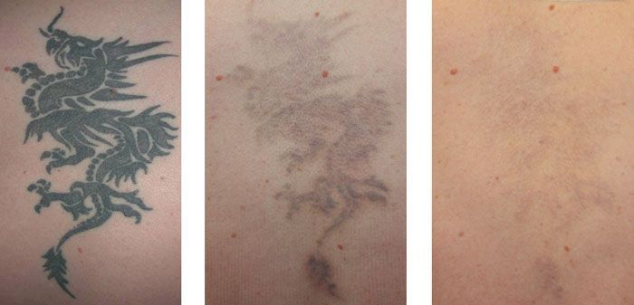 Tatuaż w domu klienta – mobilnie, profesjonalnie