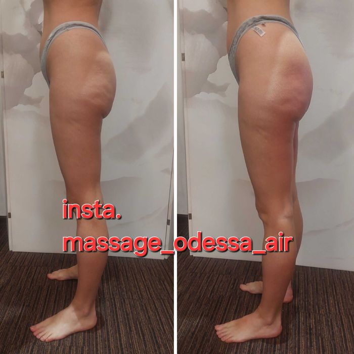 Масаж спини / загальний масаж / лімфодренаж / антицелюлітний