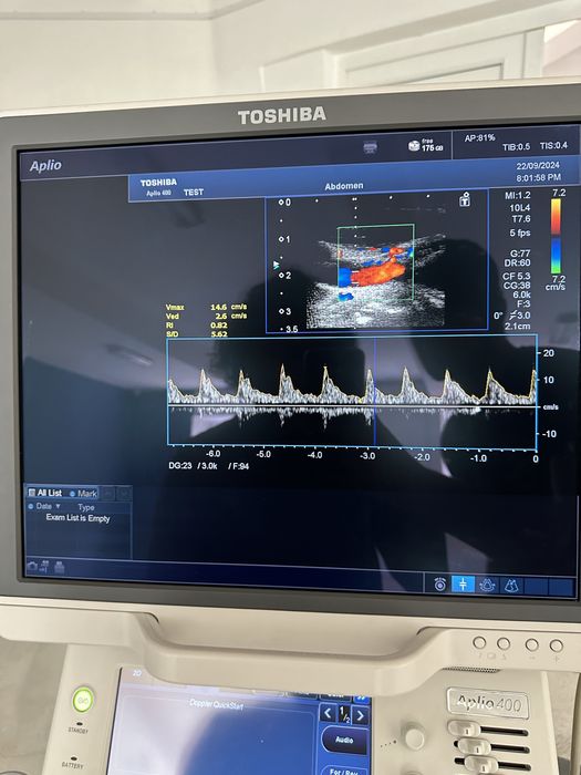 Toshiba Aplio 400 2013р. 2 датчика УЗИ УЗД Апарат Сканер