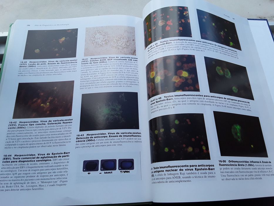 Vendo Atlas de Microbiologia Clínica. Novo.