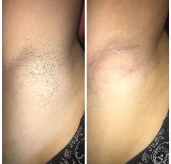 Мастер депиляции (воск, шугаринг), косметолог, массаж