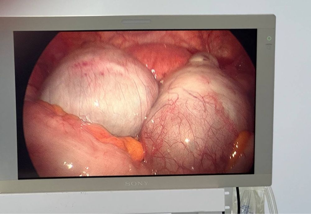 Монітор медичний sony 24