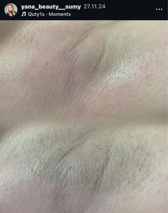 Жіночий Шугаринг | Троїцька | Центр