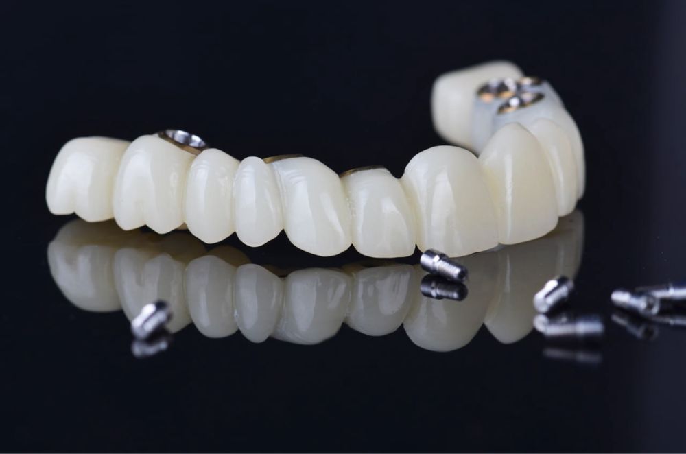 Зуботехнічна лабораторія пропонує співпрацю. Зубний технік.