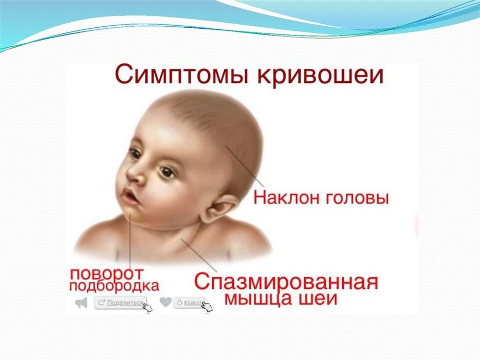 Масаж для немовлят.Визов до дому.Кропивницкий.