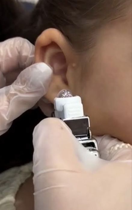 Прокол ушей без шума