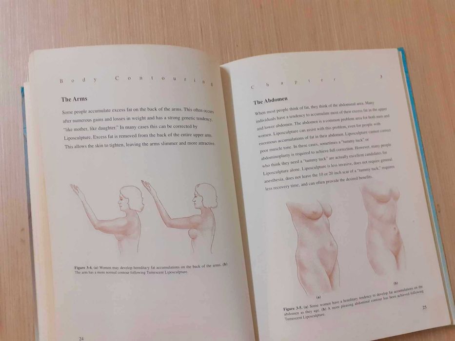 Body Contouring: The New Art of Liposculpture