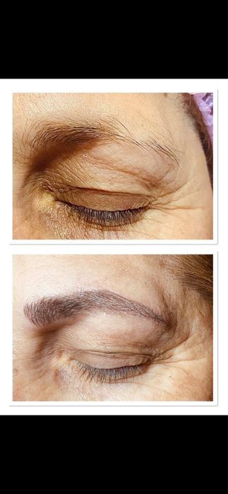 Migroblading fio a fio