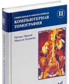 Прокоп М., Галански Спиральная и многослойная компьютерная томография.