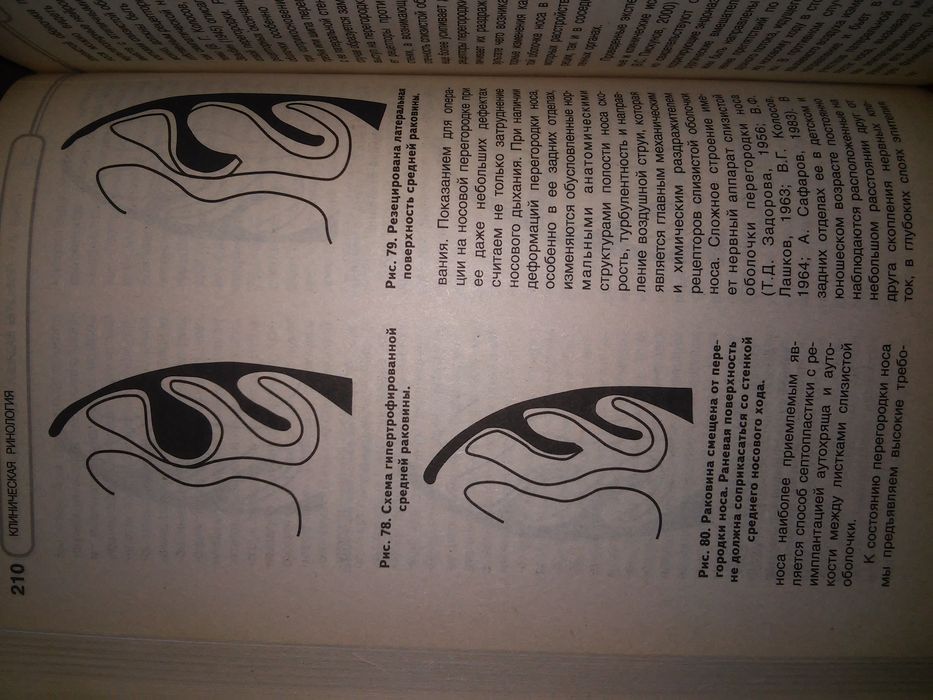 Пискунов Клиническая ринология. 2002