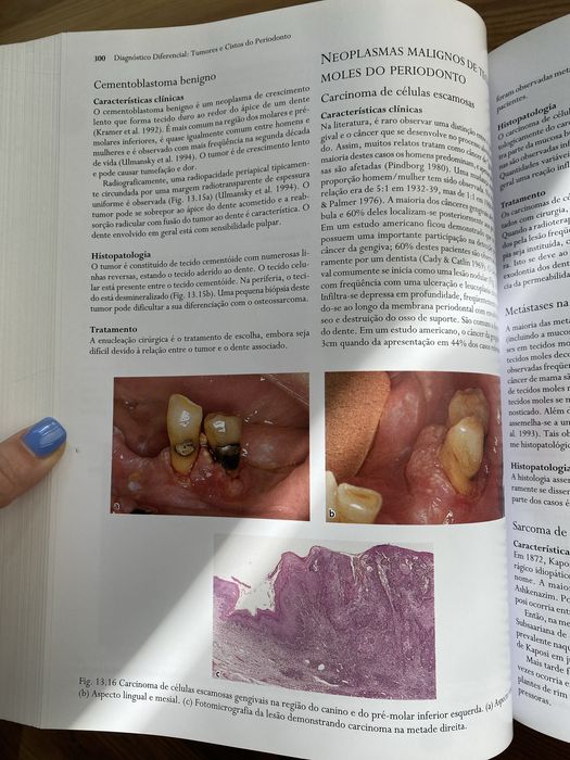 Livro Tratado de Periodontologia Clínica e Implantologia Oral
