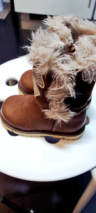 Botaa castanhas em pele de menina