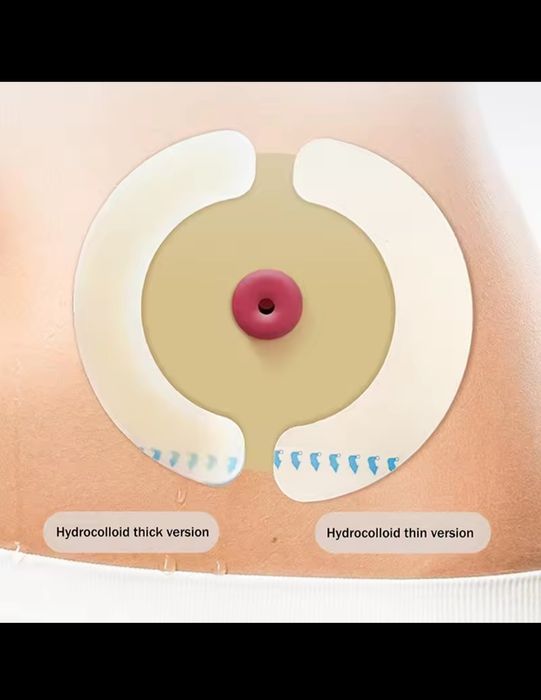 Pierścień uszczelniający do stomii