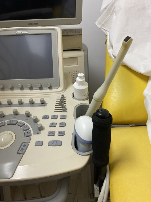 ecografo preparado para ginecologia/obste com impressora e ecram tv