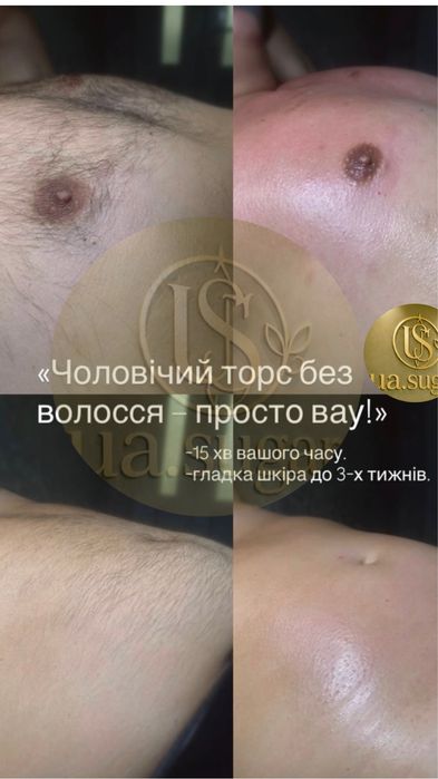 Чоловіча, жіноча депіляція, шугаринг, Миколаїв.