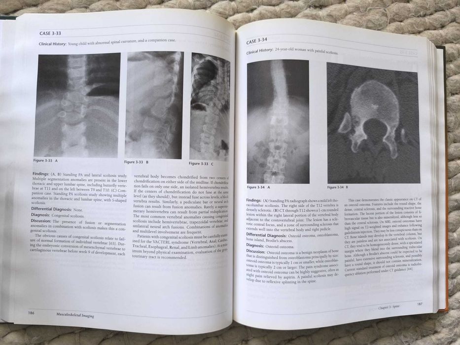 Livro "Musculoskeletal Imaging: A Teaching File" de Felix Chew