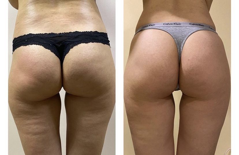 Масаж/Харків  поруч з метро ( Григорія Сковороди 79/1)