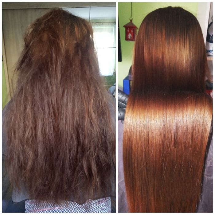 Keratynowe prostowanie, Krioterapia, NANOPLASTIA, Botox