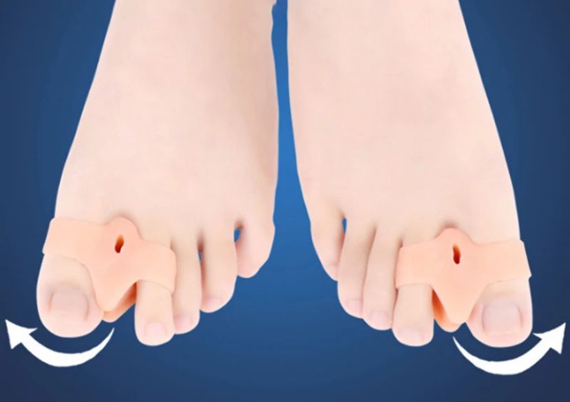 Corretor de joanete, dedo dos pés o par produto de silicone