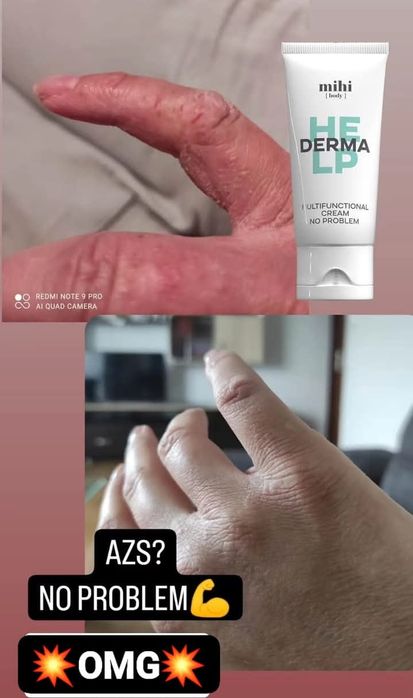 Krem Wielofunkcyjny NO PROBLEM 75ml