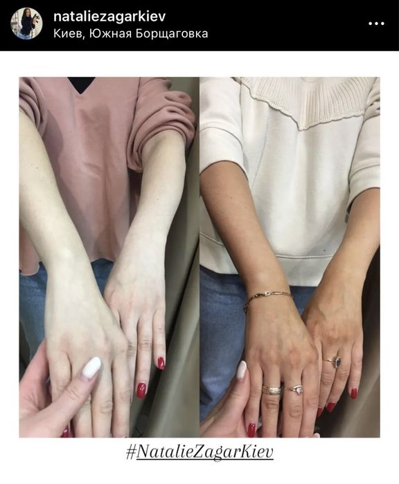 МИТТЕВА ЗАСМАГА  Київ  /  МОМЕНТАЛЬНЫЙ Тростниковый Загар в Киеве